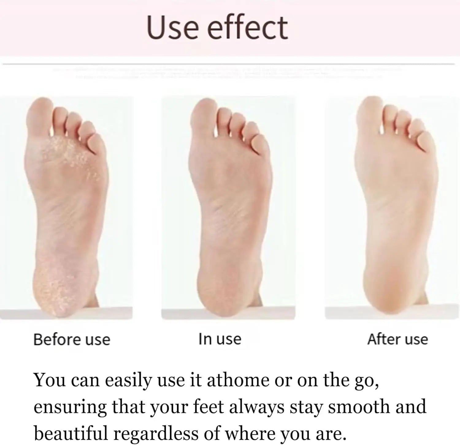 SmoothTouch™ Electric Callus Remover