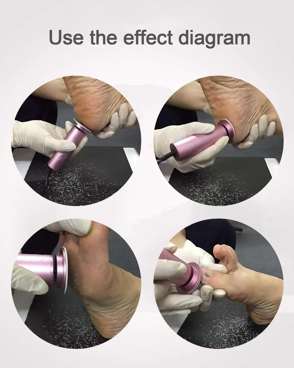 SmoothTouch™ Electric Callus Remover