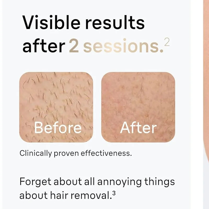 SilkaLaser™ Precision Hair Removal System