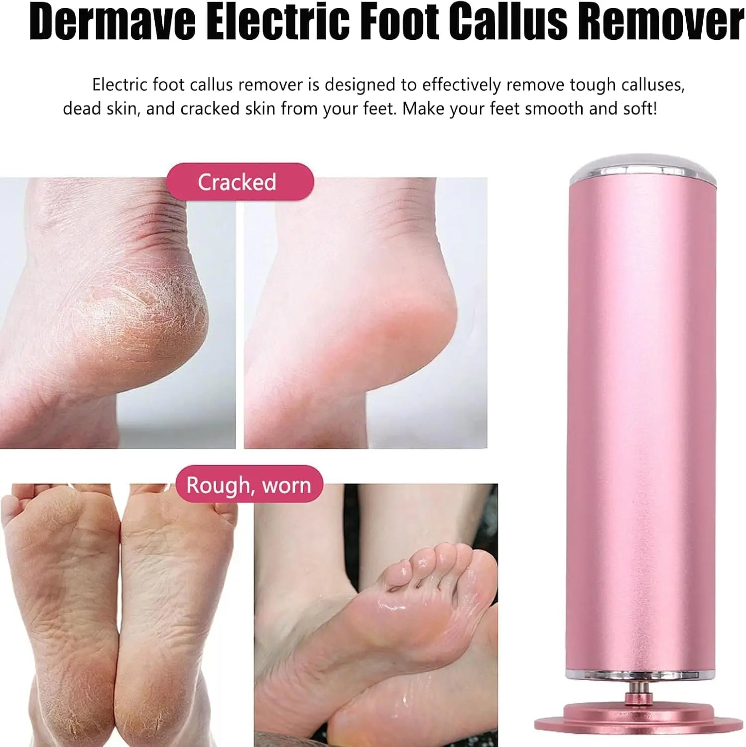 SmoothTouch™ Electric Callus Remover