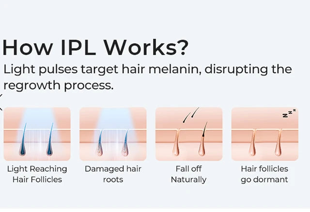 SilkaLaser™ Precision Hair Removal System